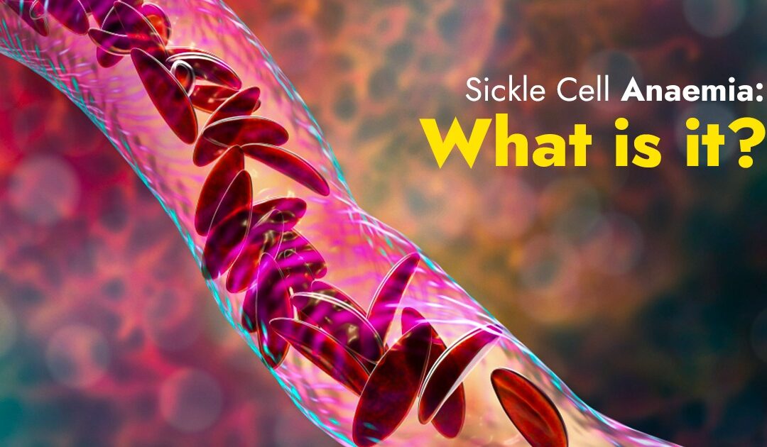 Sickle Cell Anaemia: What is it?