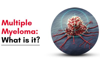  Multiple Myeloma: What is it?